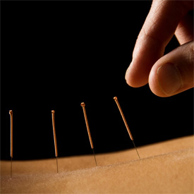 Acupuncture / TCM