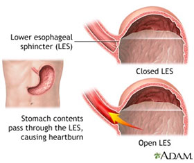 lower esophageal sphincter diagram