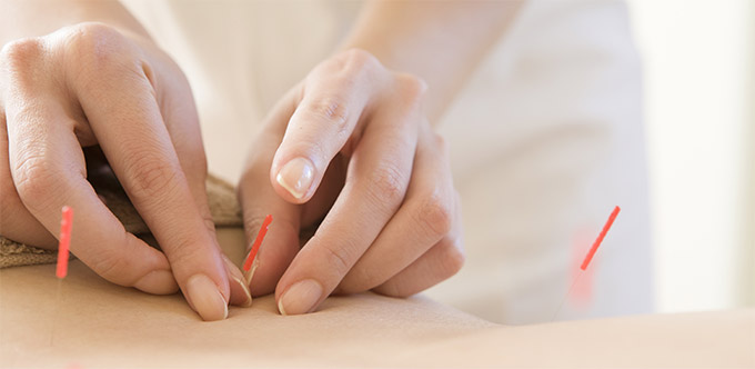 fertility-acupuncture-treatment