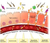 Leaky Gut Syndrome