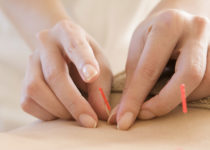 acupuncture for pain and injuries