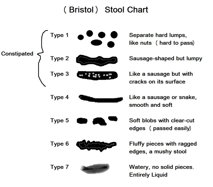Bristol stool scale chart